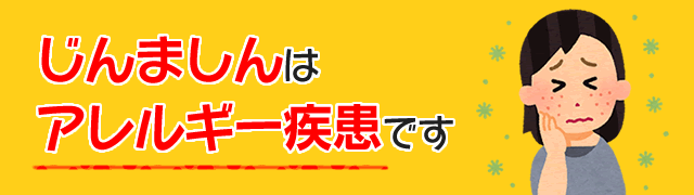 じんましんはアレルギー疾患です