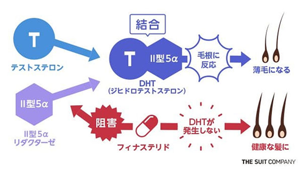 スーパーフィナステリドの効果