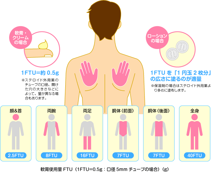 ステロイド外用量の目安(FTU)