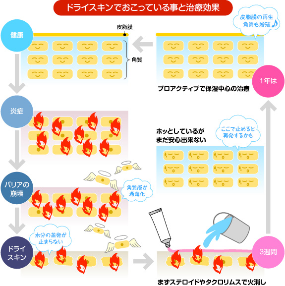 ドライスキンでおこっている事と治療効果