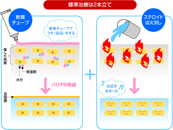 標準治療は2本立て