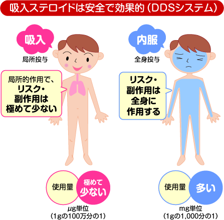 吸入ステロイドは安全で効果的（DDSシステム）