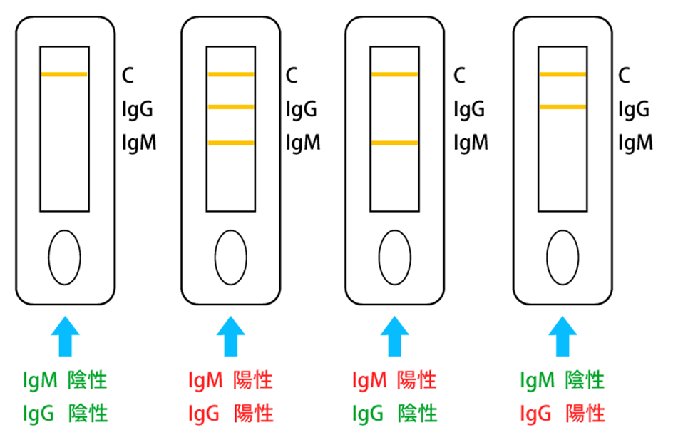 新型コロナウイルス抗体検査