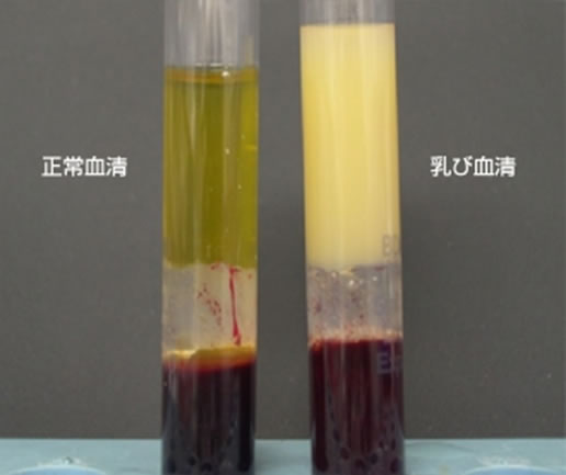 中性脂肪(TG、トリグリセライド)≧175または悪玉LDLコレステロール≧160の方の血液