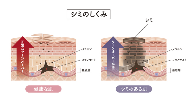 シミの仕組み