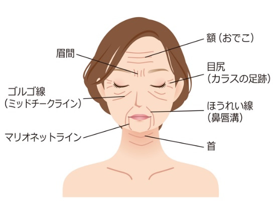 しわ・たるみ
