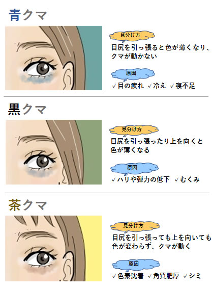 クマ・くすみ