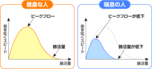 フローボリューム曲線