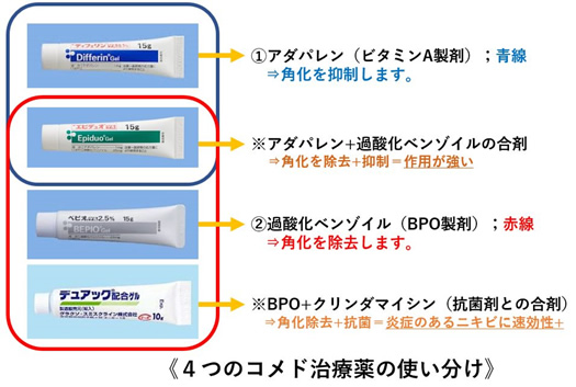 4つのコメド治療薬の使い分け