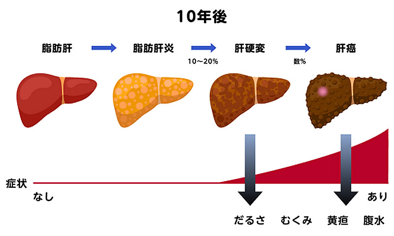 ゼニカル・オルリファスト