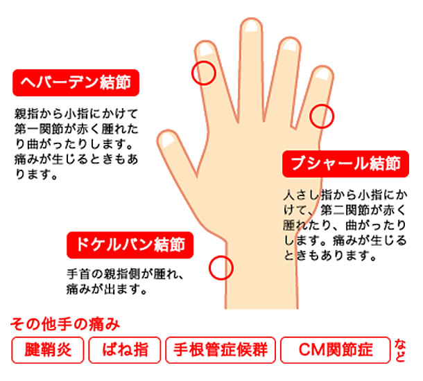 手の痛み・しびれ